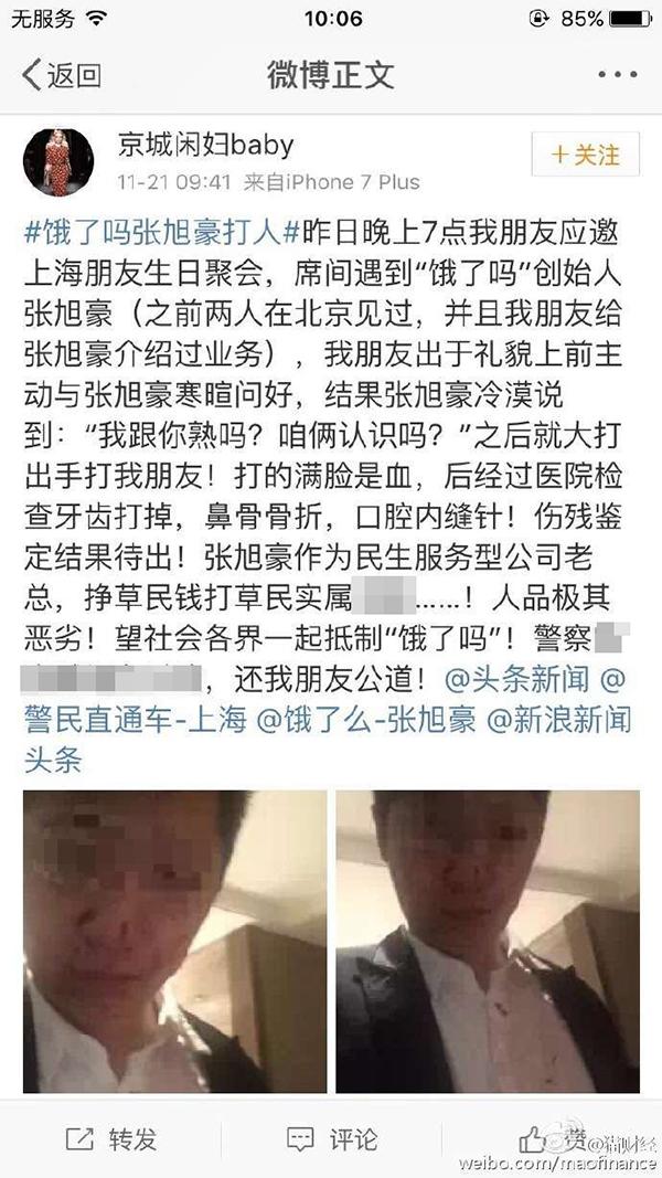 CEO把人打骨折？餓了么稱是私人事件 與公司無關(guān)